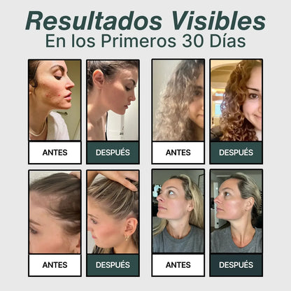 Pack Cabezal+ Filtros-AquaRain